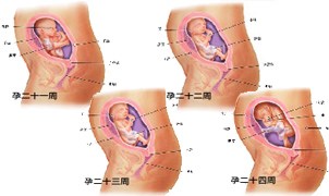 怀孕6月胎儿图