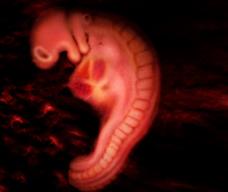 怀孕40天胎儿图