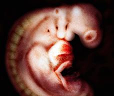 怀孕44天胎儿图