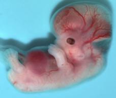 怀孕49天胎儿图