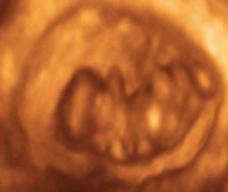 怀孕61天胎儿图