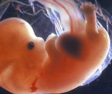 怀孕63天胎儿图