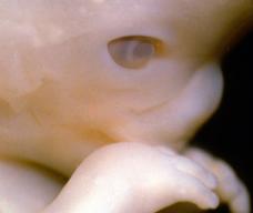 怀孕64天胎儿图