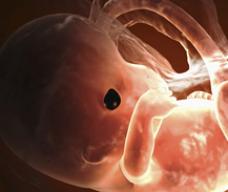 怀孕69天胎儿图