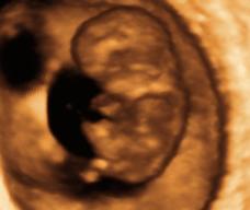 怀孕71天胎儿图