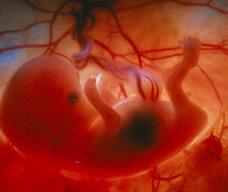怀孕73天胎儿图