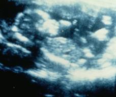 怀孕143天胎儿图