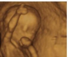 怀孕94天胎儿图