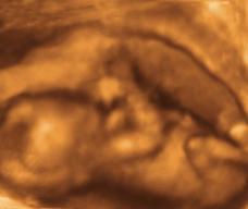 怀孕110天胎儿图