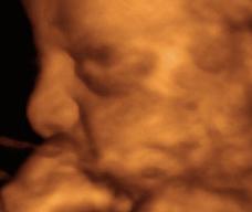 怀孕150天胎儿图