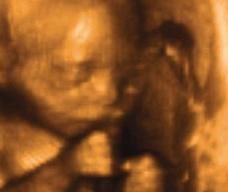 怀孕161天胎儿图