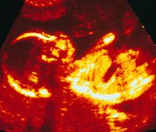怀孕162天胎儿图