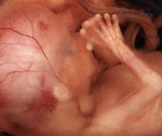 怀孕119天胎儿图