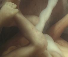 怀孕120天胎儿图