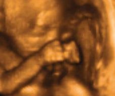 怀孕166天胎儿图