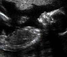 怀孕167天胎儿图