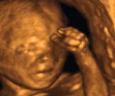 怀孕123天胎儿图