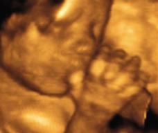 怀孕171天胎儿图