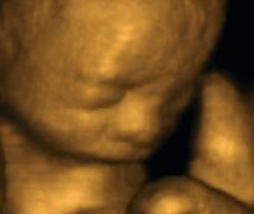 怀孕174天胎儿图