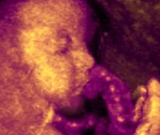 怀孕176天胎儿图