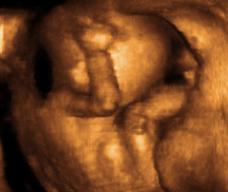 怀孕127天胎儿图
