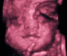 怀孕180天胎儿图