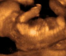 怀孕130天胎儿图