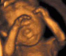 怀孕131天胎儿图