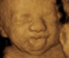 怀孕184天胎儿图