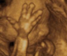 怀孕185天胎儿图