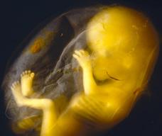 怀孕133天胎儿图