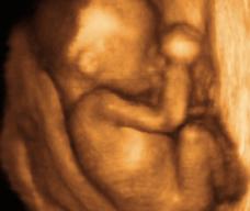 怀孕134天胎儿图
