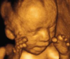 怀孕189天胎儿图