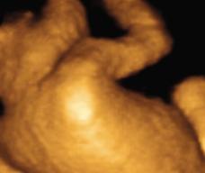 怀孕192天胎儿图