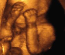 怀孕138天胎儿图