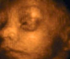 怀孕198天胎儿图