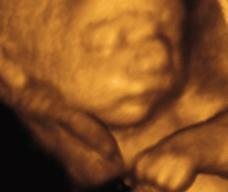怀孕199天胎儿图