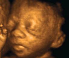 怀孕200天胎儿图