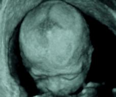 怀孕201天胎儿图