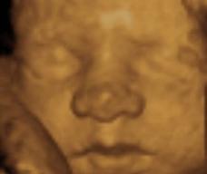 怀孕207天胎儿图
