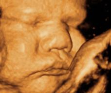 怀孕273天胎儿图
