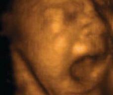 怀孕210天胎儿图