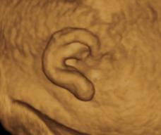 怀孕274天胎儿图