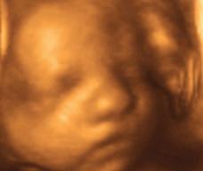 怀孕211天胎儿图
