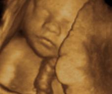 怀孕215天胎儿图