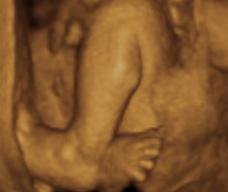 怀孕216天胎儿图
