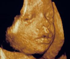 怀孕217天胎儿图