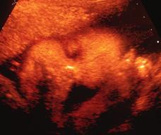 怀孕278天胎儿图