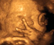 怀孕218天胎儿图