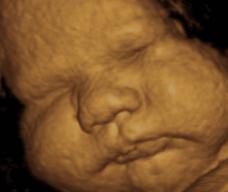 怀孕279天胎儿图